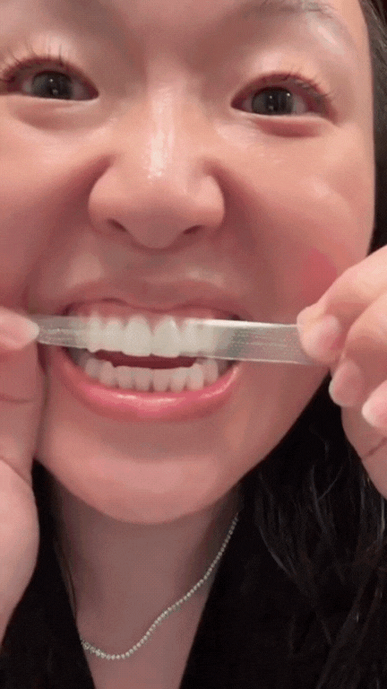 Bandes de blanchiment LumySmile™ – 14 pièces